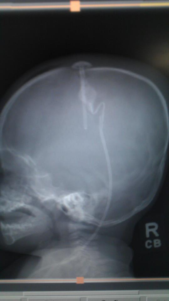 399270_10151139331836316_253408060_n