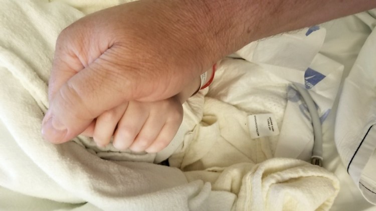 Xavier-hydrocephalus-seattle-1